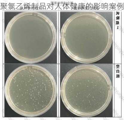 聚氯乙烯制品对人体健康的影响案例